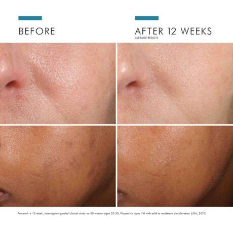 Phloretin-CF-with-Ferulic-Acid-635494328004-SkinCeuticals6