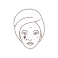 Hyperpigmentace, Melasma