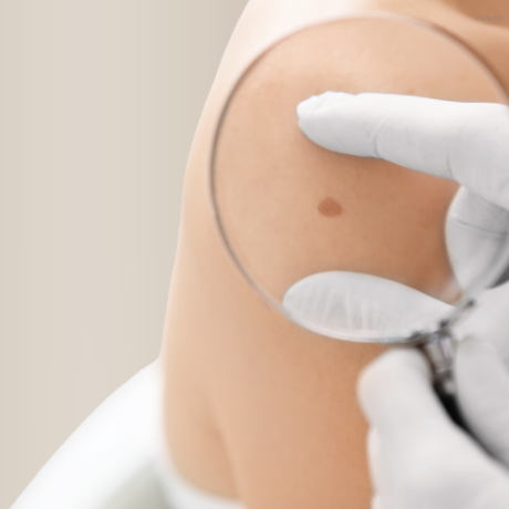 D-2-1-1_Vysetreni znamenek FotoFinder_hlavni_obrazek