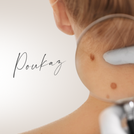 D-2-1-2_Vysetreni znamenek rucnim dermatoskopem_hlavni_obrazek