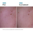 2298359_-_2025_SKC_PTIOX_CREAM_SERUM_CREAM_PHASE1_ALT_IMAGES_INTL_PRODUCT_BEFORE_AFTER_cs-CZ_8817329