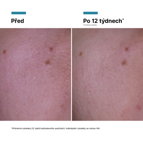 2298359_-_2025_SKC_PTIOX_CREAM_SERUM_CREAM_PHASE1_ALT_IMAGES_INTL_PRODUCT_BEFORE_AFTER_cs-CZ_8817329
